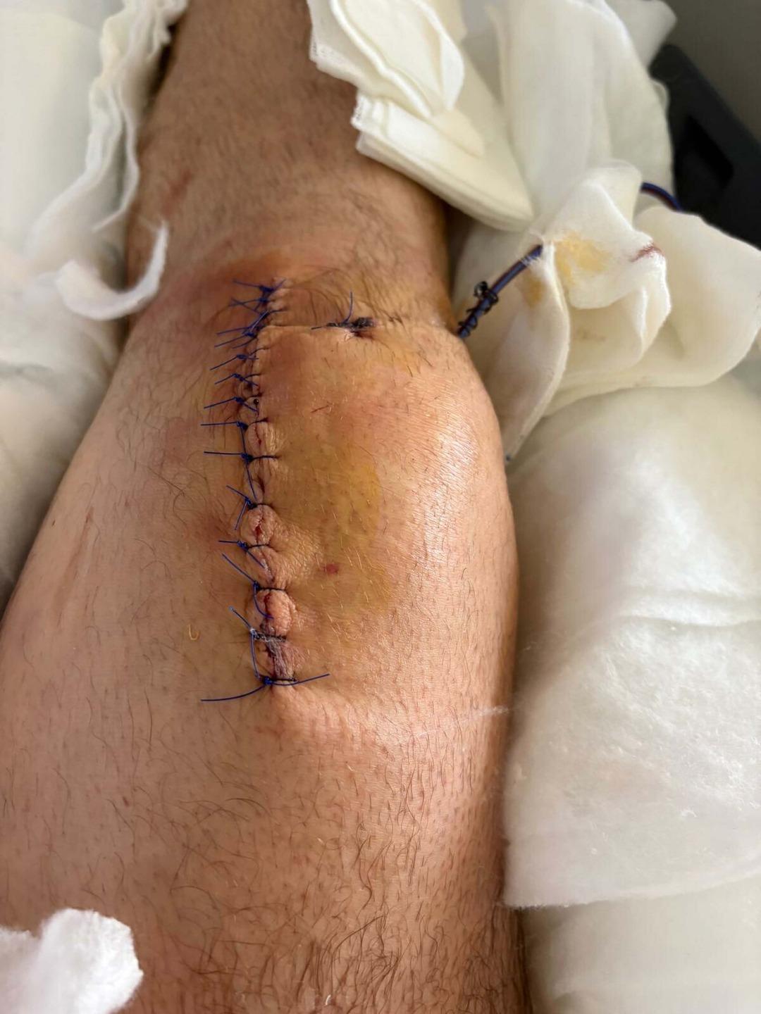 İş insanına evinin &ouml;n&uuml;nde silahlı saldırı şoku: "Başıma hedef aldı, can g&uuml;venliğim yok" 4