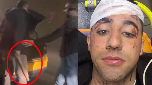 Kağıthane'de taksici tartıştığı motosikletliye sopayla saldırdı: Kafama 10 defa vurdu