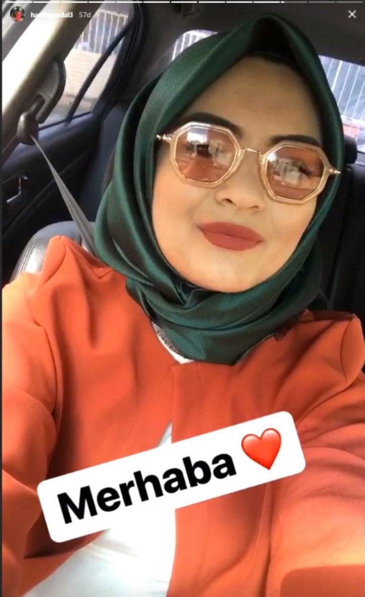 Estetik yaptıran Hanife isyan ettirdi! G2