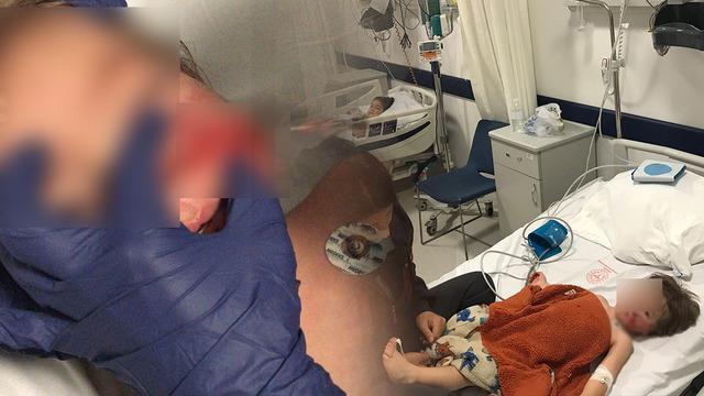 Ankara'da korkunç olay! Pitbull cinsi köpek küçük çocuklara saldırdı