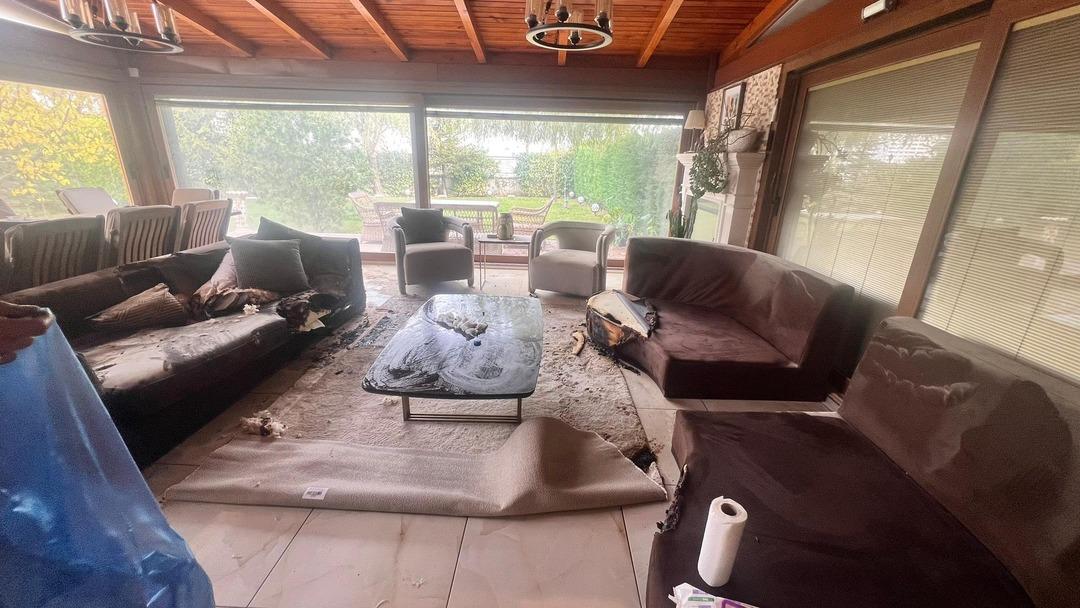 "Kimse evine bu ürünü sokmasın” uyarısı! Dekoratif şömine patladı: Vücudunun %30’u yaralandı 3