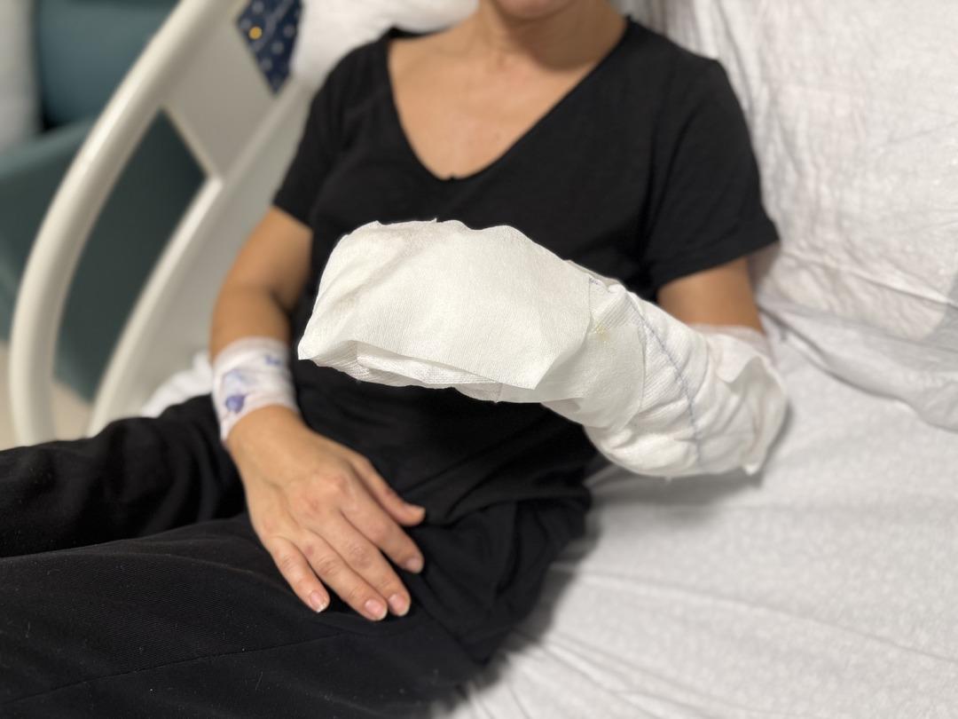 "Kimse evine bu ürünü sokmasın” uyarısı! Dekoratif şömine patladı: Vücudunun %30’u yaralandı 5