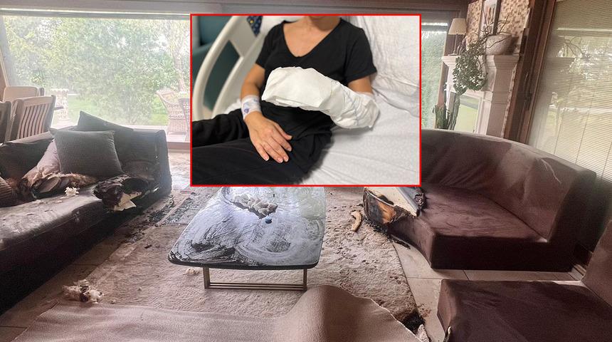 "Kimse evine bu ürünü sokmasın” uyarısı! Dekoratif şömine patladı: Vücudunun %30’u yaralandı
