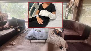 Kimse evine bu ürünü sokmasın” uyarısı! Dekoratif şömine patladı: Vücudunun %30’u yaralandı
