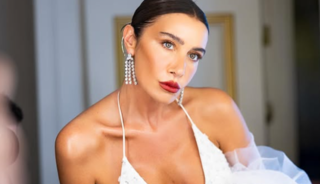 Botoks ve dolguyu abarttı! Görenler "Bu kim?" dedi