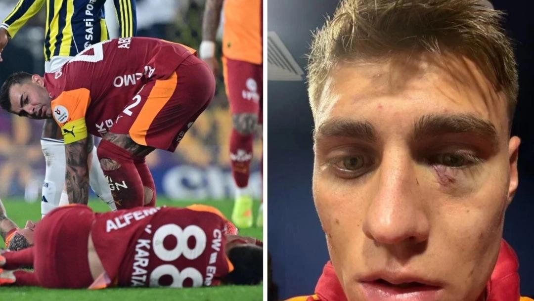 Derbide attığı cisimle Galatasaraylı Kazımcan Karataş ı yaralamıştı! G&ouml;zaltına alındı: İşte cezası... 2