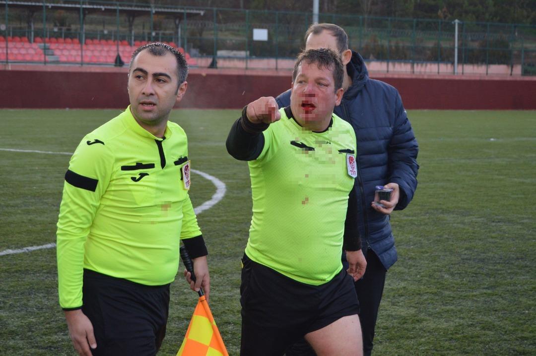 Eskişehir de hakeme saldırı kameraya yansıdı! Hakem kanlar içinde kaldı 2