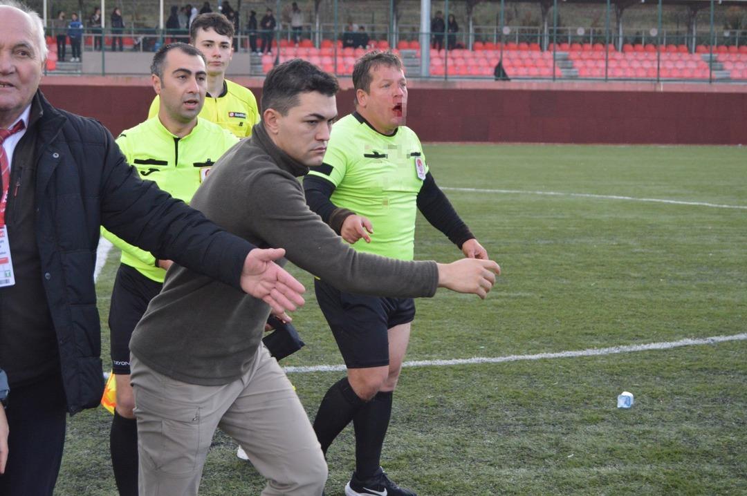 Eskişehir de hakeme saldırı kameraya yansıdı! Hakem kanlar içinde kaldı 3