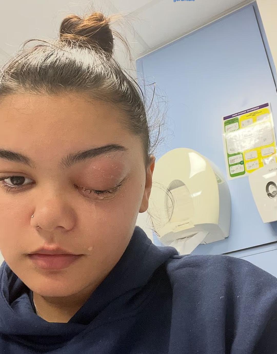 Soğuk algınlığı deyip geçmeyin: Çocuğunuzda bu belirtiler varsa aman dikkat!  Gözümden irin akıyordu  2