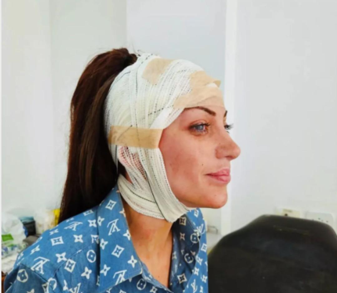  İnsan Barbie  olarak biliniyordu: Fenomenin ölümünün ardındaki sır perdesi aralandı 3