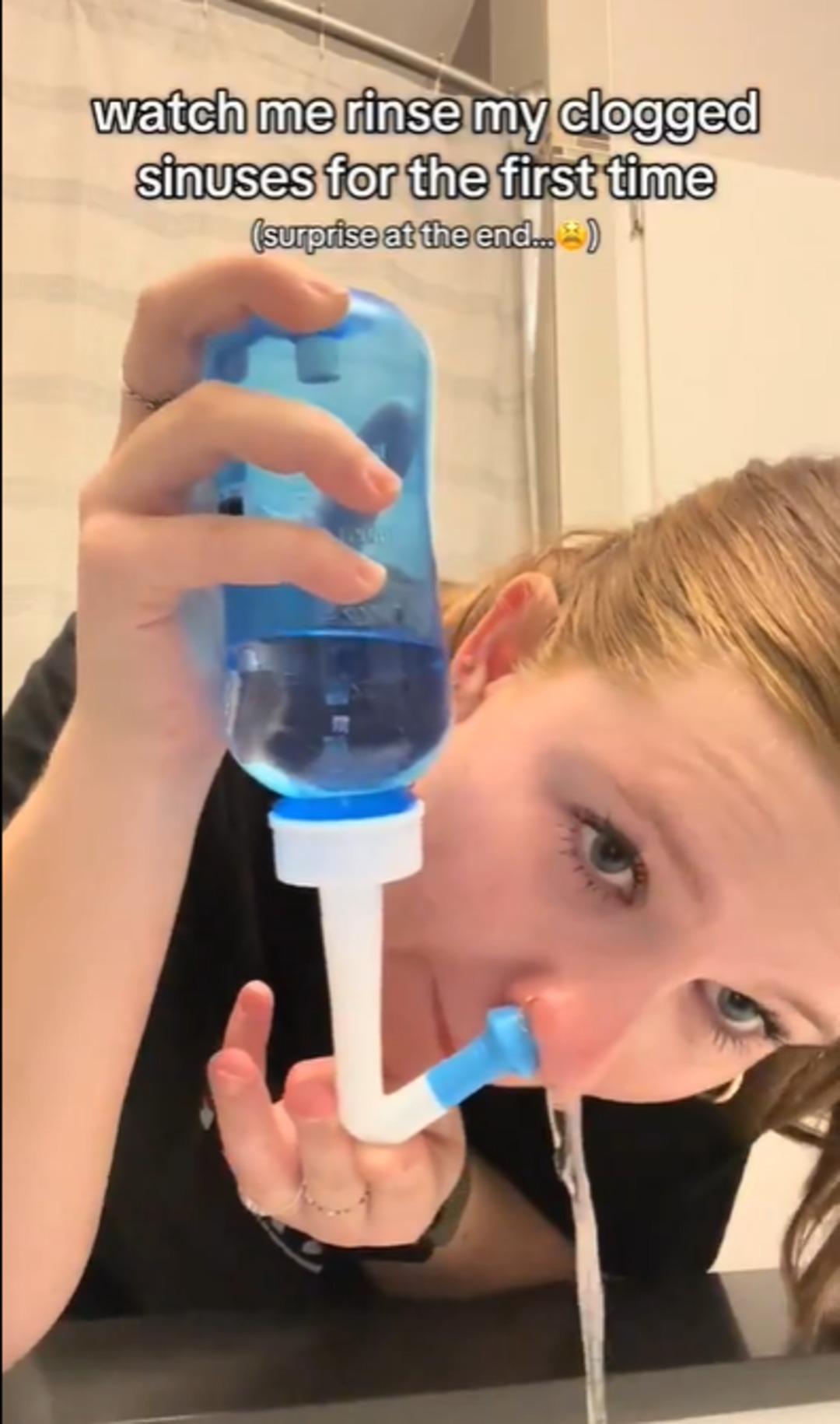 Burnundan &ccedil;ıkanlar sosyal medyada viral oldu! &Ccedil;ok konuşulan y&ouml;ntemin gizli detayları 1