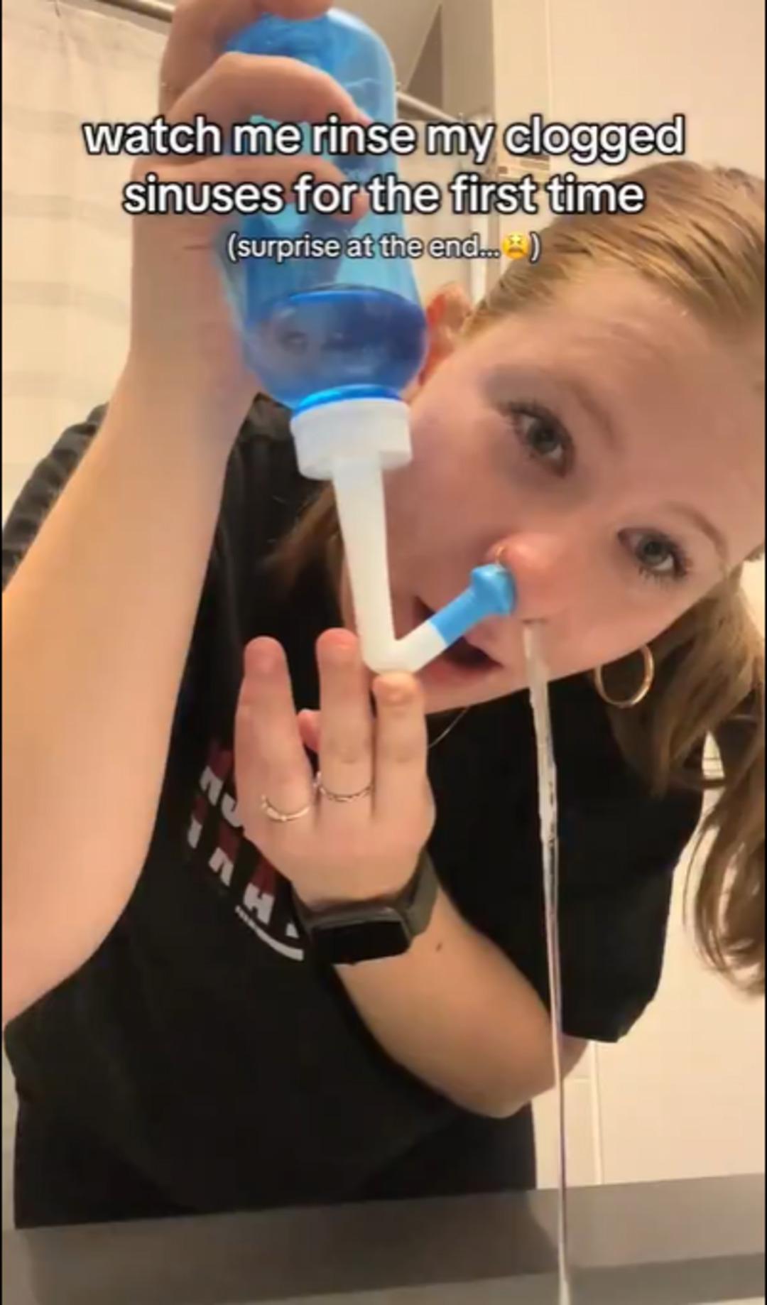 Burnundan &ccedil;ıkanlar sosyal medyada viral oldu! &Ccedil;ok konuşulan y&ouml;ntemin gizli detayları 2