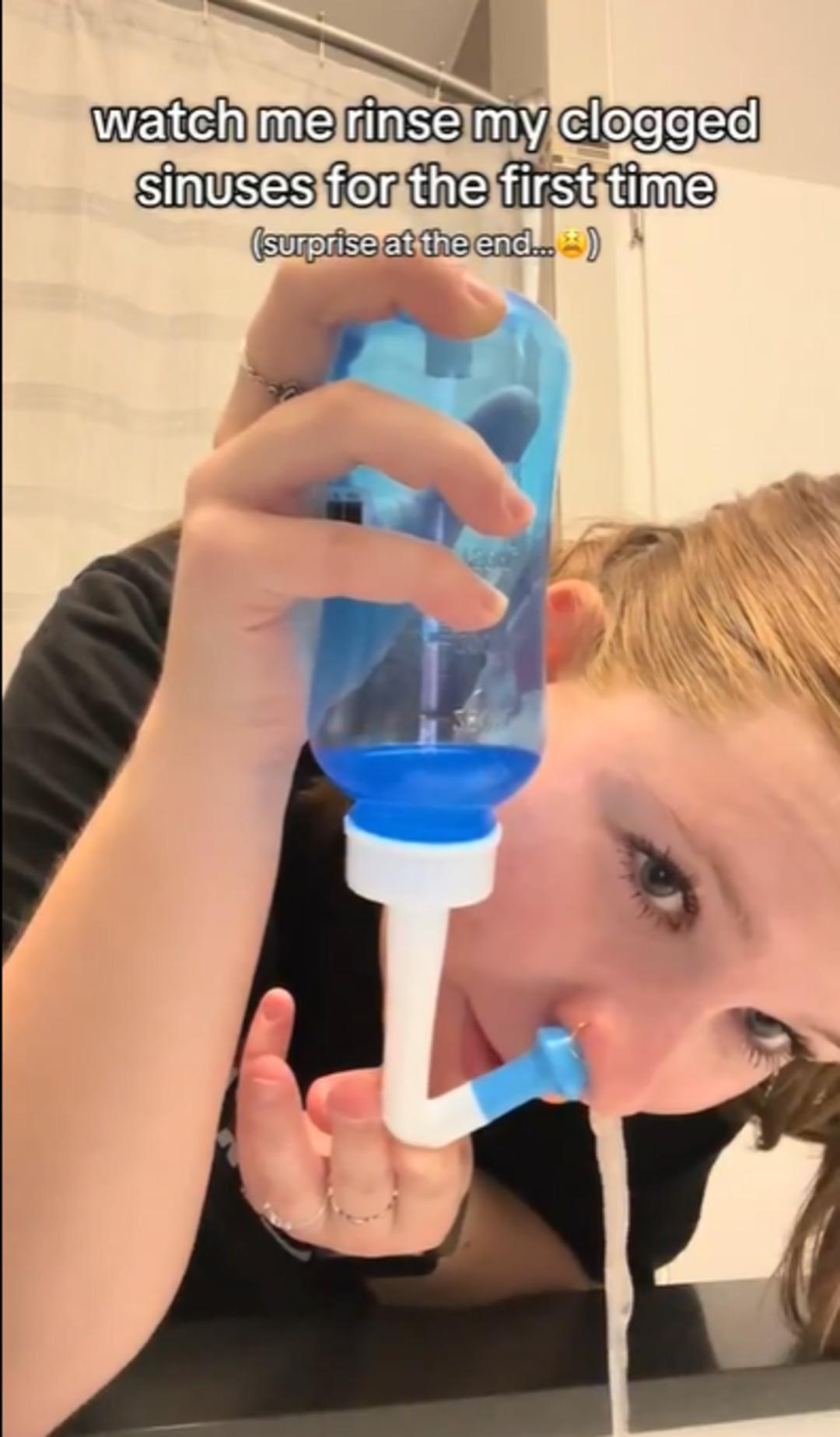 Burnundan &ccedil;ıkanlar sosyal medyada viral oldu! &Ccedil;ok konuşulan y&ouml;ntemin gizli detayları 3