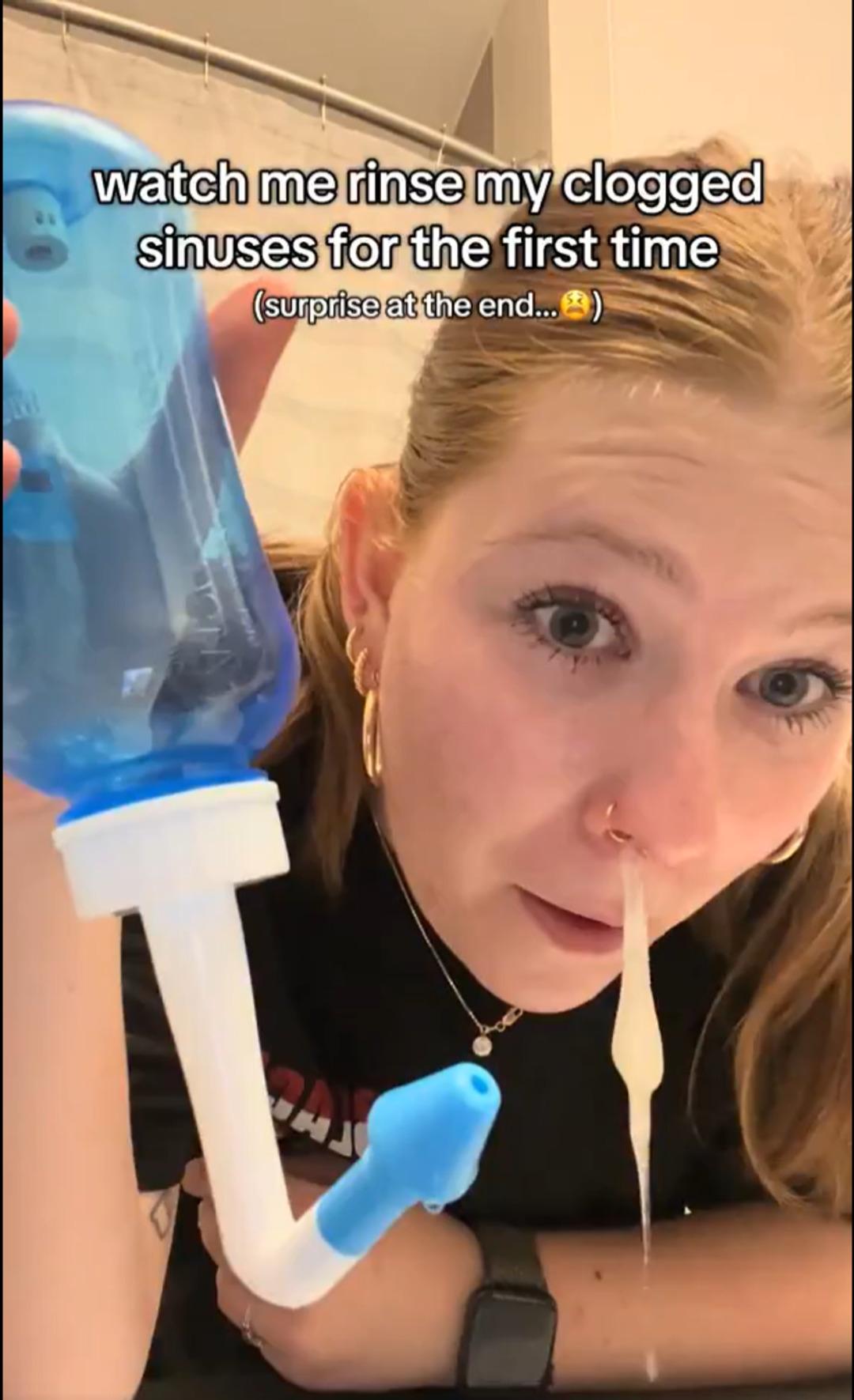 Burnundan &ccedil;ıkanlar sosyal medyada viral oldu! &Ccedil;ok konuşulan y&ouml;ntemin gizli detayları 4