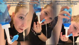 Burnundan çıkanlar sosyal medyada viral oldu!