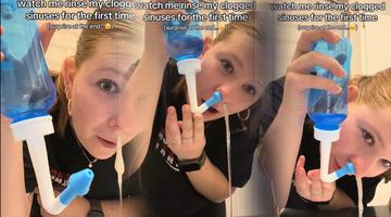 Burnundan çıkanlar sosyal medyada viral oldu! Çok konuşulan yöntemin gizli detayları