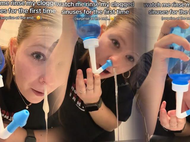 Burnundan çıkanlar sosyal medyada viral oldu!