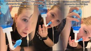 Burnundan çıkanlar sosyal medyada viral oldu! Çok konuşulan yöntemin gizli detayları