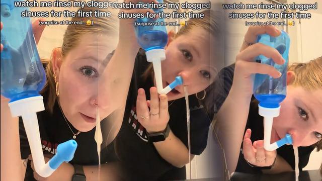 Burnundan çıkanlar sosyal medyada viral oldu! Çok konuşulan yöntemin gizli detayları