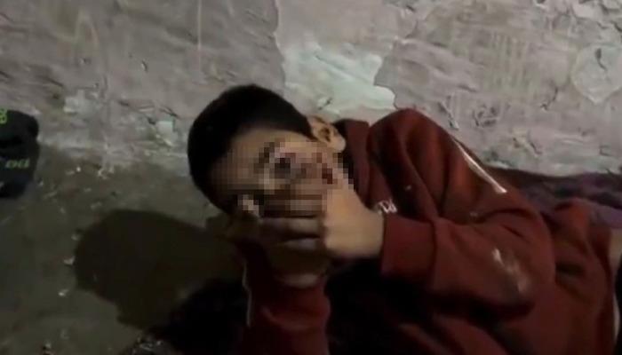 Engelli çocuğu yıllarca kümeste tutmuş! 