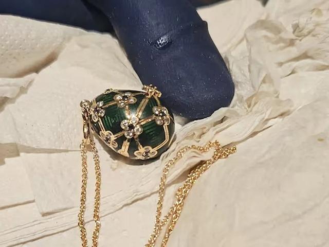 19 bin 500 dolarlık kolyeyi yuttu! 