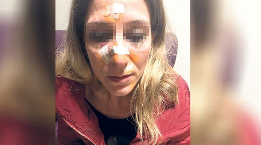 Koruma kararının bitmesinin ardından dehşet sa&ccedil;tı