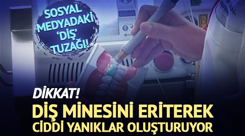 Sosyal medyadaki 'diş' tuzağı: Diş minesini eriterek ciddi yanıklar oluşturuyor!