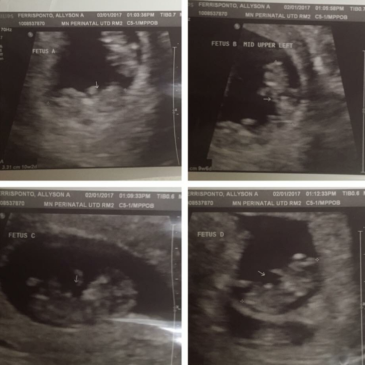 Dünyayı hayrete düşüren olay!  G2