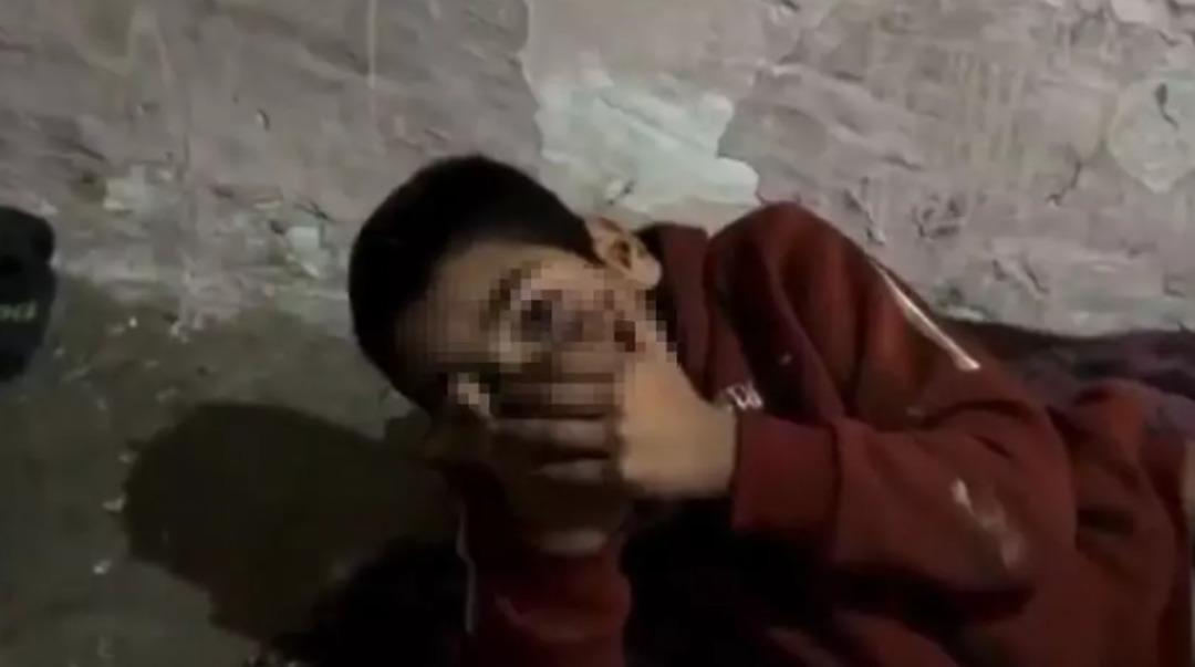 Güvercin kümesinde ekmekle suyla beslenmiş... Utancın fotoğrafı! 12 yaşındaki Adnan ı yıllarca kimse farketmemiş 1