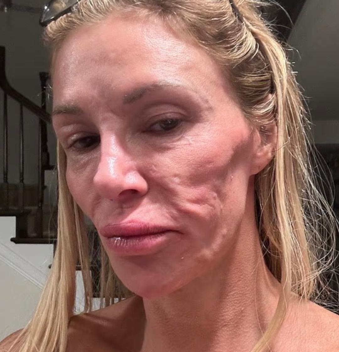 Ünlü TV yıldızının yüzünün hali korkutuyor! Sorunu bulmak için 130 bin dolar harcadı 1