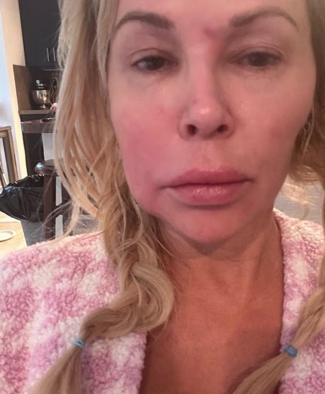 Ünlü TV yıldızının yüzünün hali korkutuyor! Sorunu bulmak için 130 bin dolar harcadı 2