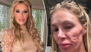 Ünlü TV yıldızının yüzünün hali korkutuyor! 2 yıldır evden çıkmıyordu