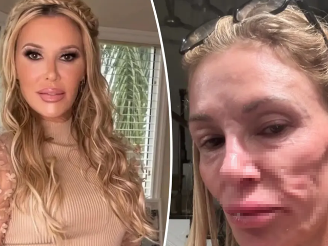 Ünlü TV yıldızının yüzünün hali korkutuyor! 2 yıldır evden çıkmıyordu