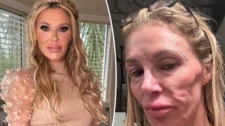 Ünlü TV yıldızının yüzünün hali korkutuyor! Sorunu bulmak için 130 bin dolar harcadı