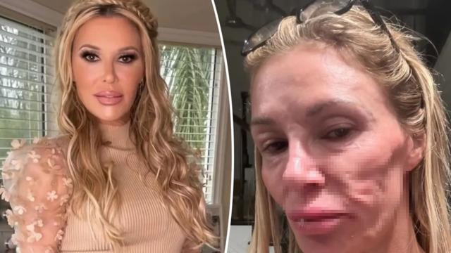 Ünlü TV yıldızının yüzünün hali korkutuyor! Sorunu bulmak için 130 bin dolar harcadı