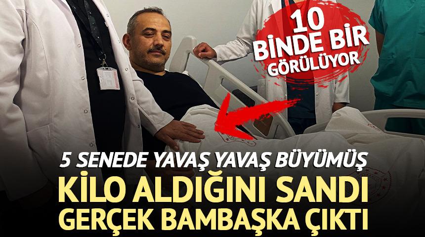 Kilo aldığını sandı, gerçek bambaşka çıktı! 5 senede yavaş yavaş büyümüş