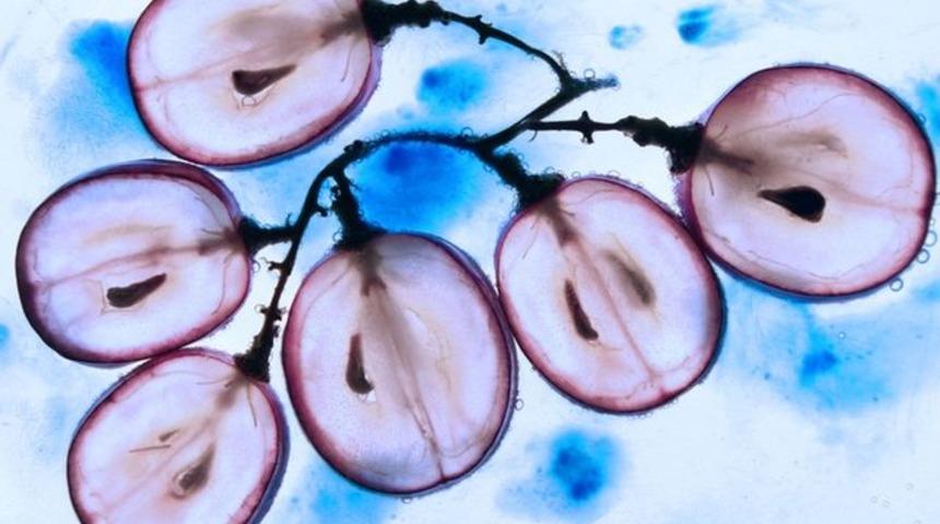 En ölümcül hastalıkları bile tedavi eden çekirdekler