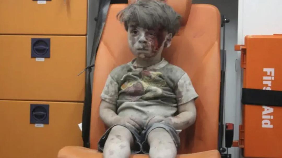 Suriye deki iç savaşın sembolü olmuştu! Ümran Bebek büyüdü: "Hayatıma ışık doğdu" 2