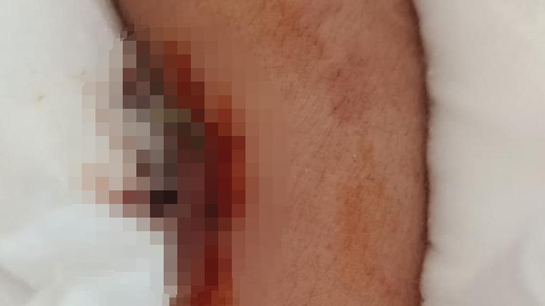 Biri 9 diğeri 8 yaşında! Kolunu 2 yerden kırdı: "Öğretmene şikayet ettiği için intikam almış" 2