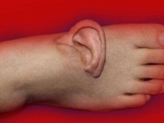 Bu olayın eşi benzeri yok: Kulağını 5 ay ayağında taşıdı