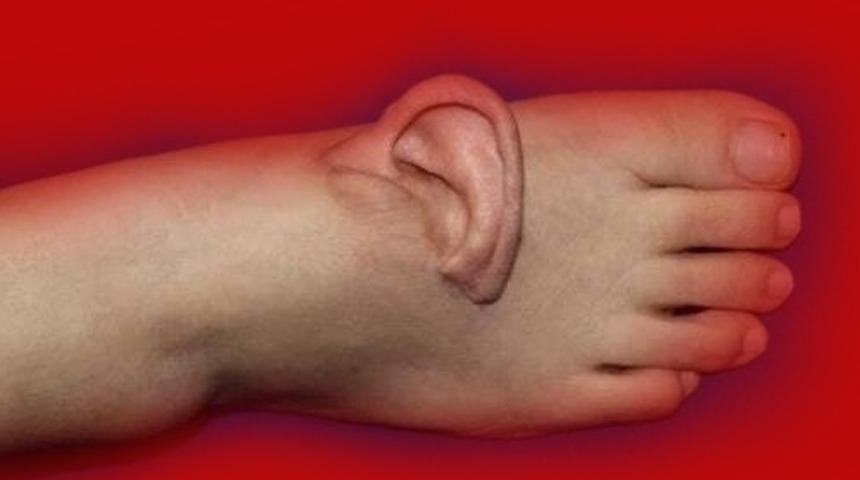 Bu olayın eşi benzeri yok: Kulağını 5 ay ayağında taşıdı