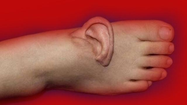Bu olayın eşi benzeri yok: Kulağını 5 ay ayağında taşıdı