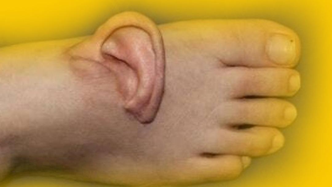 Bu olayın eşi benzeri yok: Kulağını 5 ay ayağında taşıdı 2