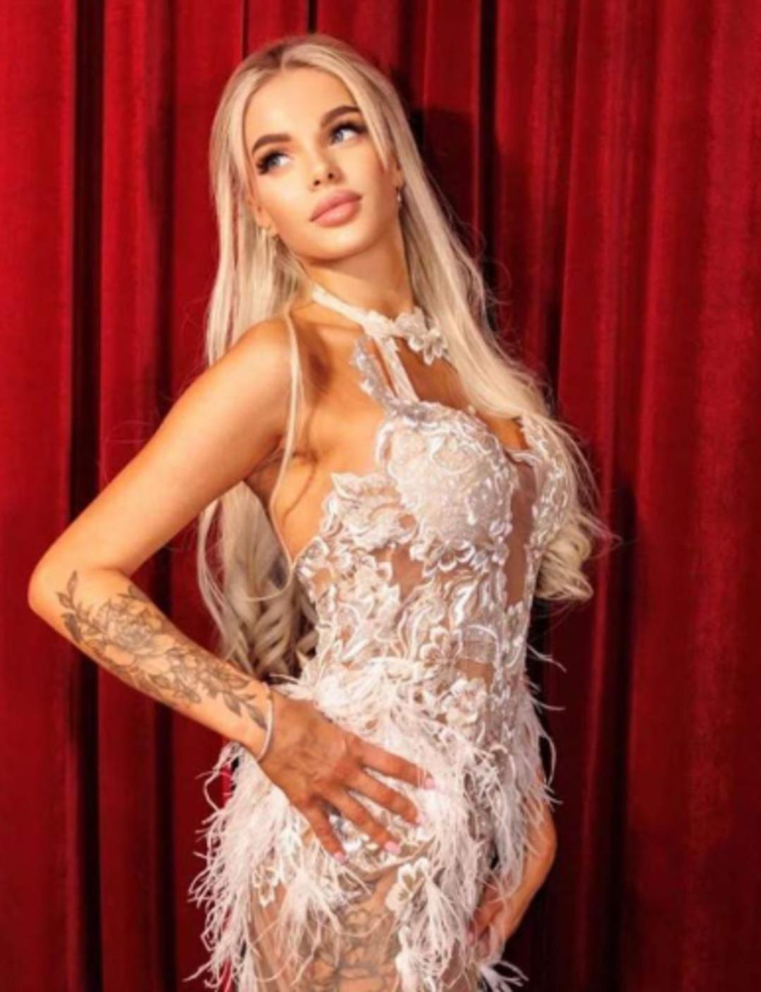 Rus modele sevgilisinden korkunç şiddet! 2 hafta sonra komada bulundu: Darbeye bağlı beyin şişliği yaşamış 3