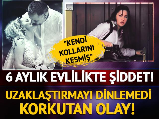  Yıldız Asyalı'nın eşi uzaklaştırma kararına uymuyor! 'Kollarını kesmiş'