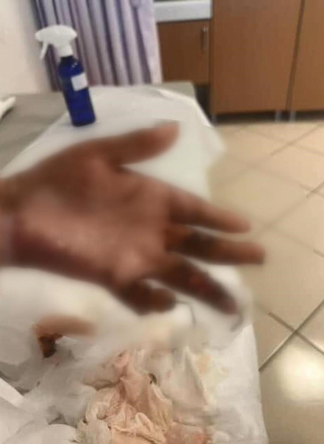 Kuaförde dehşet! 14 yaşındaki çocuk tanınmaz halde:  Kapı sıkışınca çıkamadım yandım  5