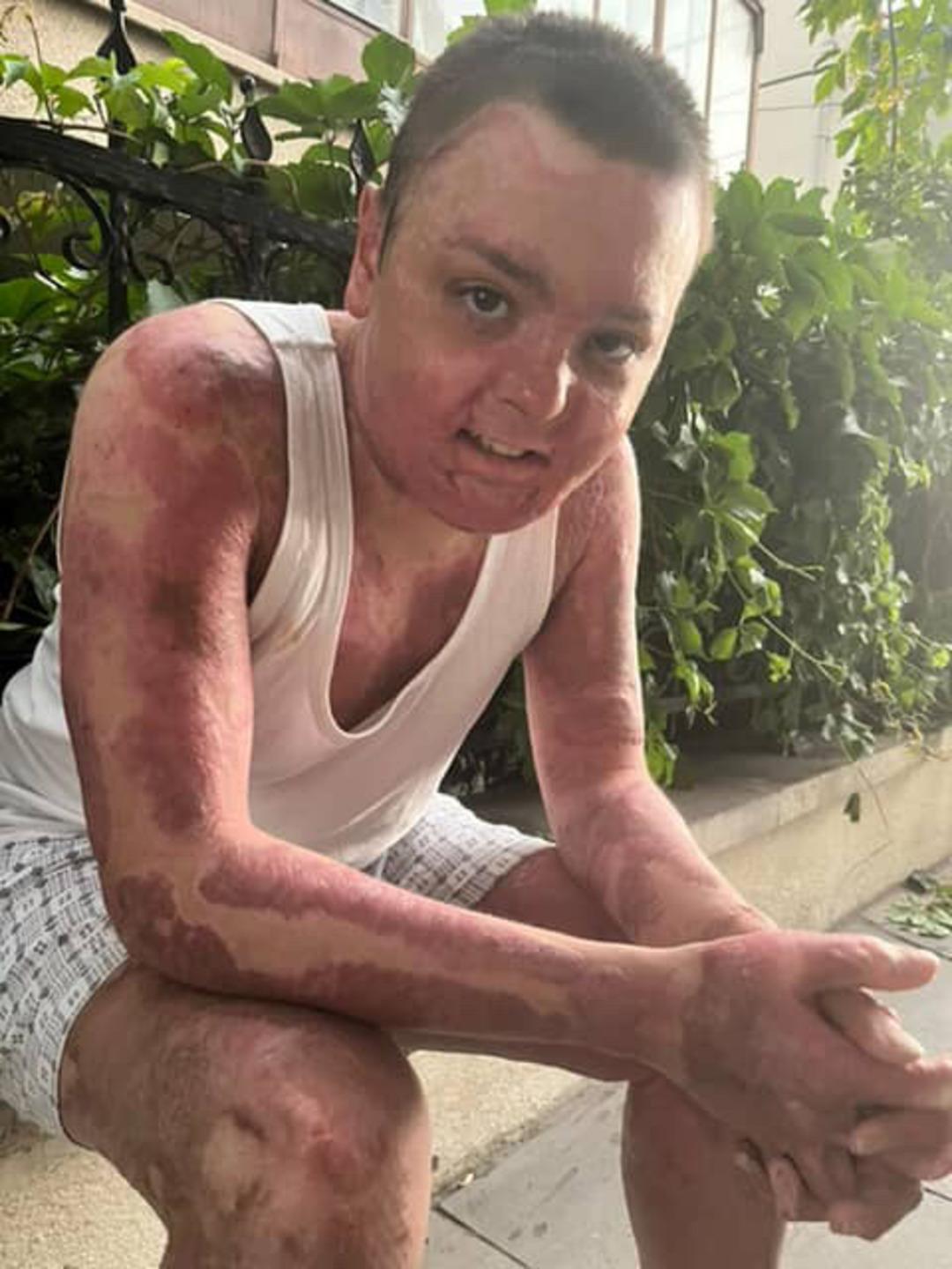 Kuaförde dehşet! 14 yaşındaki çocuk tanınmaz halde:  Kapı sıkışınca çıkamadım yandım  2