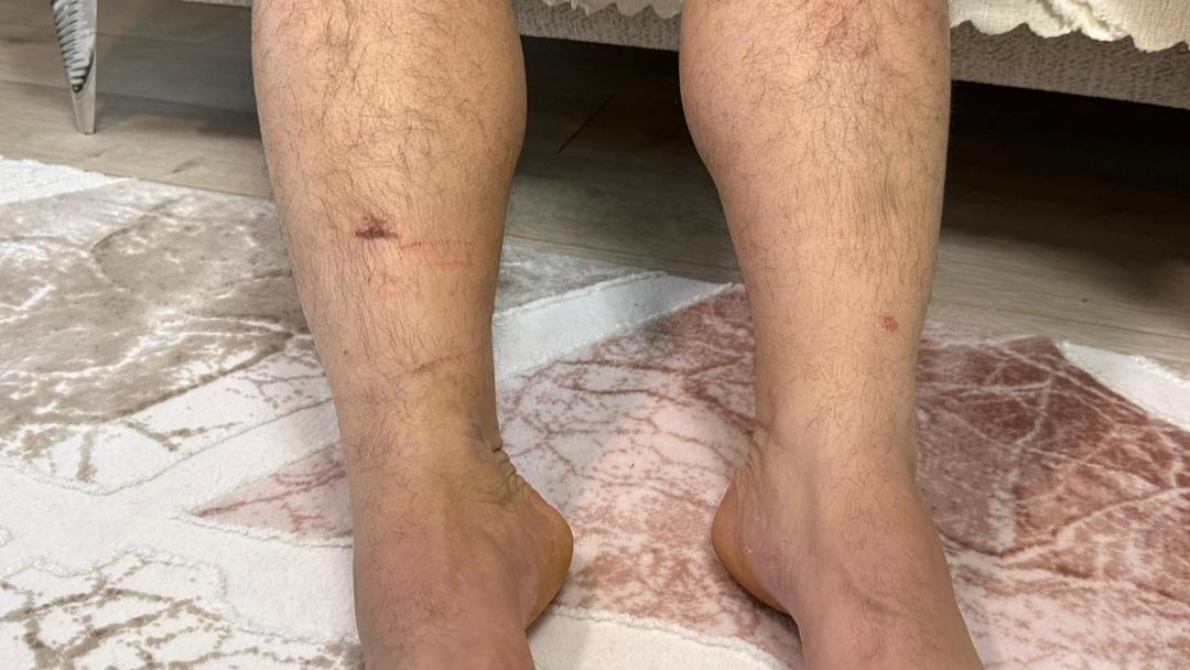 Diyarbakır da 8 saatlik kuzen işkencesi: "Koş, beni bağladılar" deyip yarı çıplak kaçtı! 3