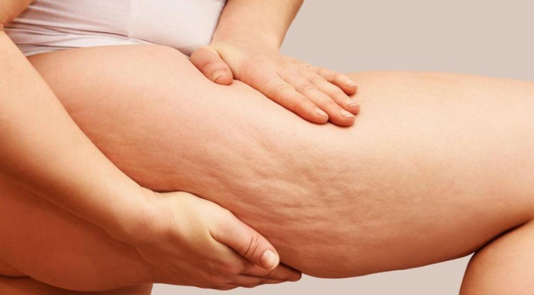 Evdeki malzemelerle selülit iksiri: Her sabah bir bardak için 2