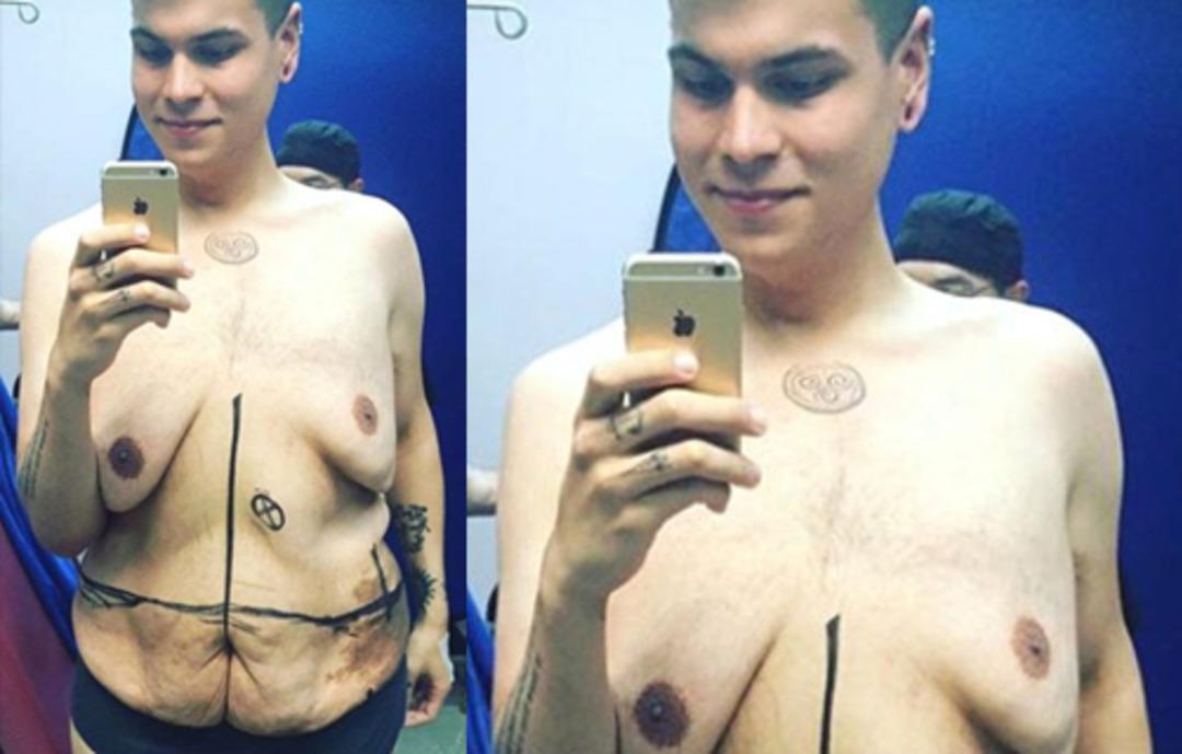 Soluğu ameliyat masasında aldı işte son hali